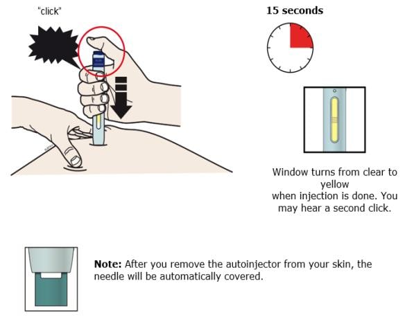 Keep pushing down on your skin. Then lift your thumb while still holding the autoinjector on your skin. Your injection could take about 15 seconds.