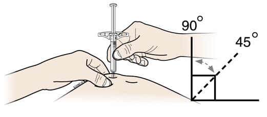 Hold the pinch. With the gray needle cap off, insert the syringe into your skin at 45 to 90 degrees.image
