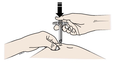 Place your finger on the plunger rod. Using slow and constant pressure, push the plunger rod all the way down until the prefilled syringe stops moving.image