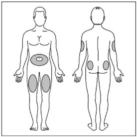 choose an injection site.image