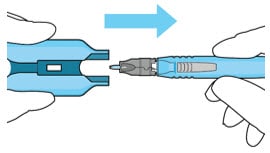 Withdraw the insertion tool handle with filled implant.image