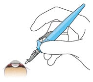 Implant insertion.image