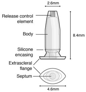 Susvimo implant detail.image