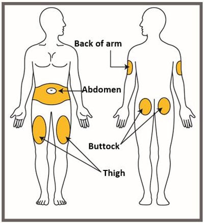 Choose the area where you will give the injection. Choose from the following recommended injection sites: back of the upper arm, abdomen, buttock, thigh.image