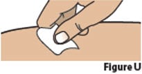 Clean the chosen injection site with an alcohol swab and let it air dry (Figure U).image