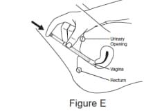 Hold the filled applicator by the grip and gently insert the tip of the applicator into your vagina as far as it will comfortably go.image