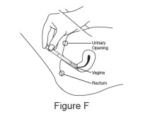 While holding the applicator in place, slowly push the plunger until it stops, to release all the XACIATO gel into your vagina.image