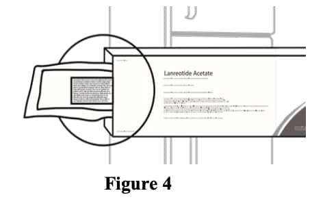 Before opening the lanreotide sterile pouch, confirm that it is intact and has not expired.