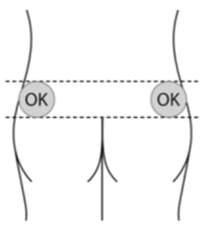 The upper outer areas of the buttock are OK sites to inject lanreotide. Only inject one area.