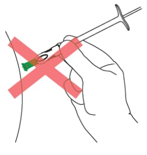 Position the green collar at the bottom of the green shield so that it is perpendicular to the lanreotide injection site. 