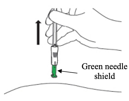 Lift the lanreotide syringe straight up and away from the body allowing the green needle shield to return to its original position and fully cover the needle.