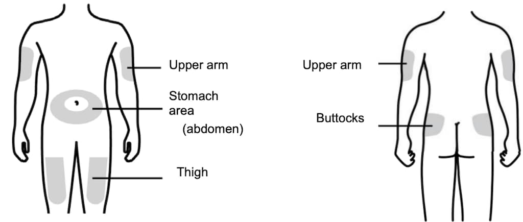 Injection sites for Releuko image.