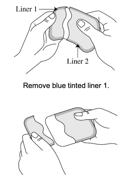 Remove the blue tinted liner 1 from the Adlarity transdermal system.