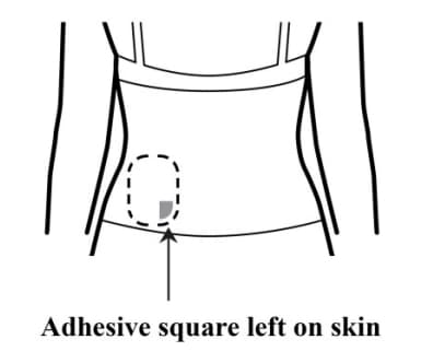 Check the application site for any remaining adhesive squares.