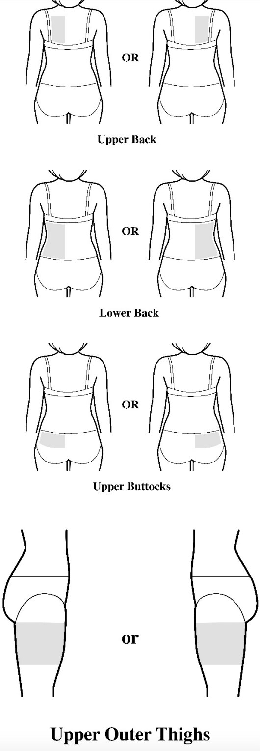 Adlarity transdermal system application sites. The recommended application site is the back.