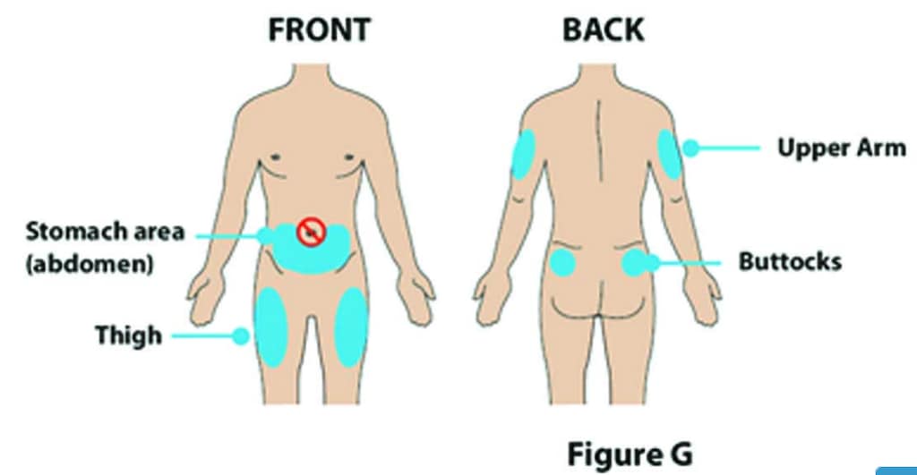 Fylnetra body injection sites image.