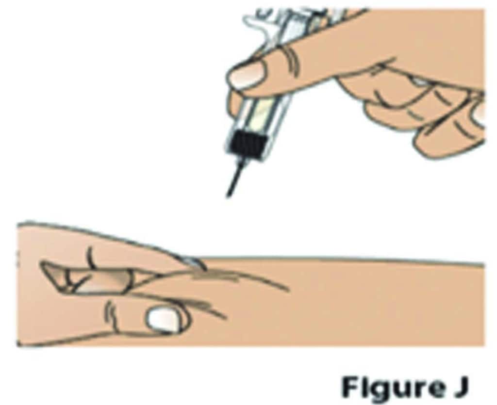 Pinch the Fylnetra injection site with your fingers to create a firm surface.