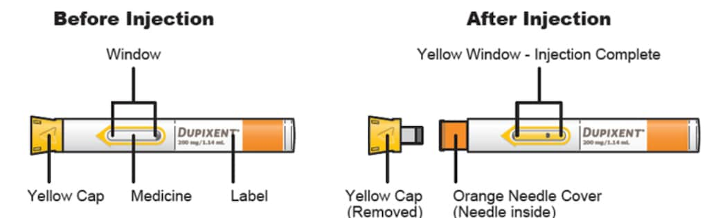 Image of the parts of a Dupixent single-dose pre-filled pen.