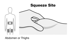 The thigh injection site is shown here (See Figure F). Perform these steps the same way for abdomen (belly) injection sites.image