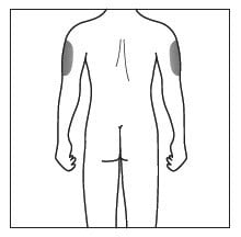 If someone else is administering the injection then the injection sites also include the upper outer arms.