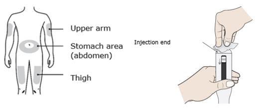 Enbrel injection sites include the thigh, stomach area (except for a 2-inch area right around your navel) and the outer area of the upper arm (only if someone else is giving you the injection) image.
