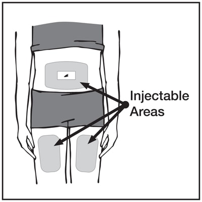 Injection sites include the front of the thighs and the lower abdomen. Do not use the area 2 inches around your belly button.