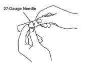 Open the wrapper that contains the 27-gauge needle by peeling apart the tabs and set the needle aside for later use image.