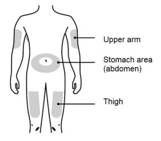 Injection sites - upper arm, stomach area and thigh image.