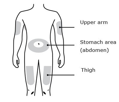 Only use these injection sites:  Your thigh Stomach area (abdomen), except for a two inch area right around your navel Outer area of upper arm (only if someone else is giving you the injection).image