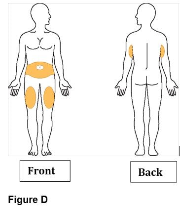 Bydureon BCise injection sites shown on image of body.