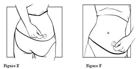 Apply the exposed sticky half of the patch to 1 of the areas of skin shown below.