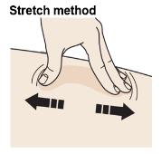 Stretch skin firmly by moving your thumb and fingers in opposite directions, creating an area about two inches wide image.