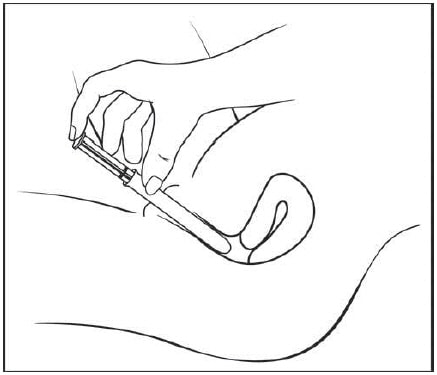 Hold the pre-filled Nuvessa applicator by the barrel and gently insert the rounded tip into your vagina as far as it will comfortably go, then pull back slightly