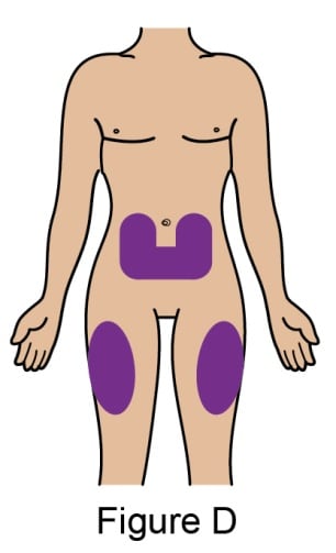 Injection sites include the stomach and thighs.