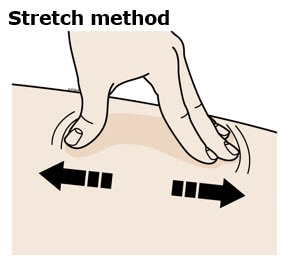 stretch method. Stretch the skin firmly by moving your thumb and fingers in opposite directions, creating an area about two inches wide.image