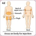 Image showing areas of the body where Bydureon can be injected - stomach, thigh and back of upper arm.