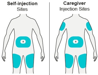 You can self-inject your Dupixent pre-filled pen in you thighs or your stomach except for the 2 inches around your belly button. A caregiver can also inject Dupixent into their site and also the upper area or your outer arm.