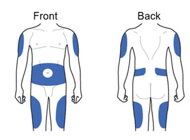 Adlyxin injection sites on body image.