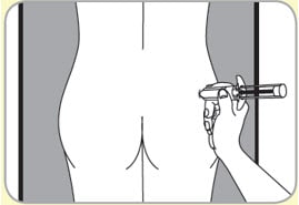 When Somatuline Depot needle is completely inserted, release injection site that has been flattened by your hand.