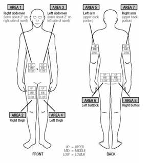 Choose an Injection Site  Extavia is injected under the skin and into the fat layer between the skin and the muscles (subcutaneous tissue). The best areas for injection are where the skin is loose and soft and away from the joints, nerves, and bones. Do not use the area near your navel (belly button) or waistline. If you are very thin, use only the thigh or outer surface of the arm for injection. Choose a different site each time you give yourself an injection. Figure 14 shows different areas for giving injections. Do not inject in the same area for two injections in a row. Keep a record of your injections to help make sure you change (rotate) your injection sites. If there are any sites that are difficult for you to reach, you can ask someone who has been trained to give the injection to you.image