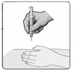 Gently pinch the skin around the site with your thumb and forefinger of the other hand (Figure 17). Insert the needle straight up and down into your skin at a 90˚ angle with a quick, dart-like motion.image