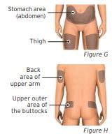 Choose your injection site (thighs, upper arms, or abdomen).image