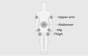 Select an area on your abdomen, thighs, hips, or upper arms for the infusion(s).image