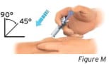 Hold the pinch. Insert the needle into the skin at 45 to 90 degrees.image