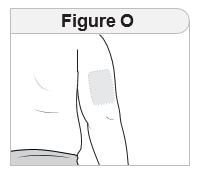 Choose the area where you will give the injection. Choose from the following recommended injection sites: back of the upper arm (figure O).image