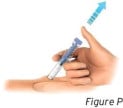 Slowly release your thumb upward. This will allow the needle to move up into the clear needle guard and cover the entire needle.image