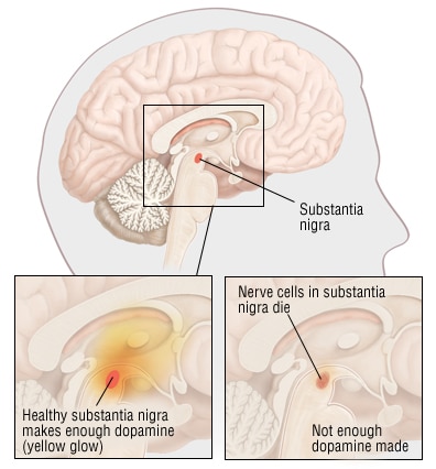 Diagram of the brain