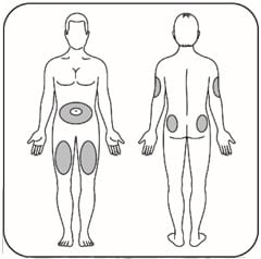 Choose your injection site from stomach area (not within 2 inches of your belly button), buttocks, upper legs or upper arms.