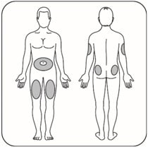 choose an injection site.image