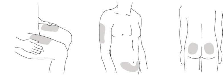 Step 2: Prepare your injection site  Choose an injection site around your stomach area (abdomen), buttocks, and upper legs (thighs). If a caregiver is giving you the injection, the outer area of the upper arms may also be used. Use a different injection site for each injection. Do not give an injection in an area of the skin that is tender, bruised, red or hard. Clean the skin with an antiseptic wipe where you plan to give your injection. Do not touch this area again before giving the injection. Let your skin dry before injecting. Do not fan or blow on the clean area. image